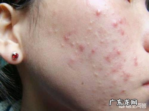 刚满月新生儿肝火过旺特别怕热怎么办?