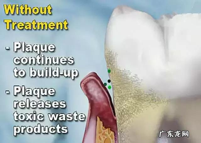 晚上刷牙后,可以再吃糖吗为什么