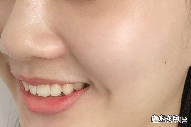 女生有胡子影响美观,应该怎么办