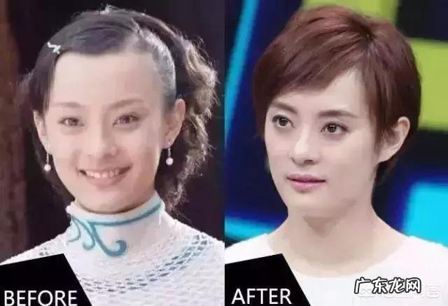 整容是不是变好看的weiyi方法还有哪些方法值得尝试