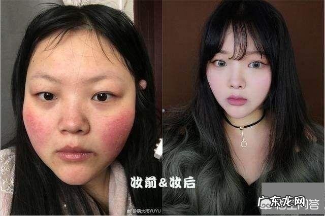 整容是不是变好看的weiyi方法还有哪些方法值得尝试