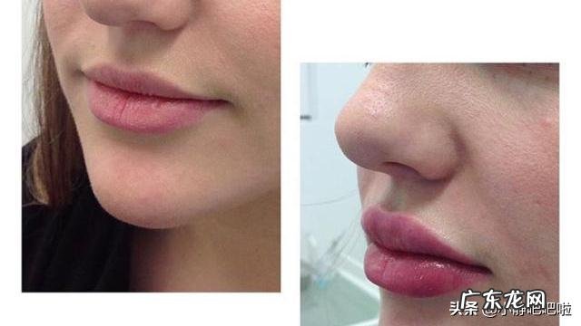 尼泊尔的穷人是如何生活的？到底差到什么地步呢？