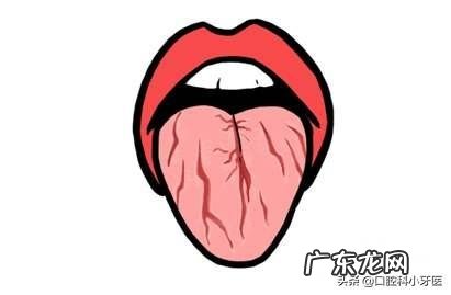 吃什么东西舌头都不舒服,口腔科看了教授、专家,说没问题,求解