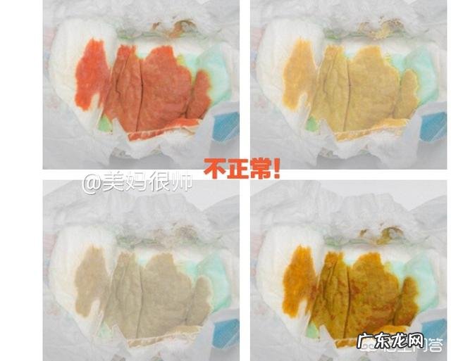 九个月宝宝大便正常,但拉绿色便便是怎么回事啊