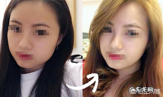 剖腹产后皮肤松弛，通过锻炼能炼出马甲线吗