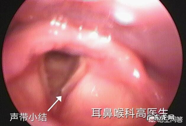 慢性咽炎吃消炎药为什么还是不能痊愈