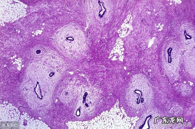 月经不调,医生给开了雌激素,吃了会不会变胖