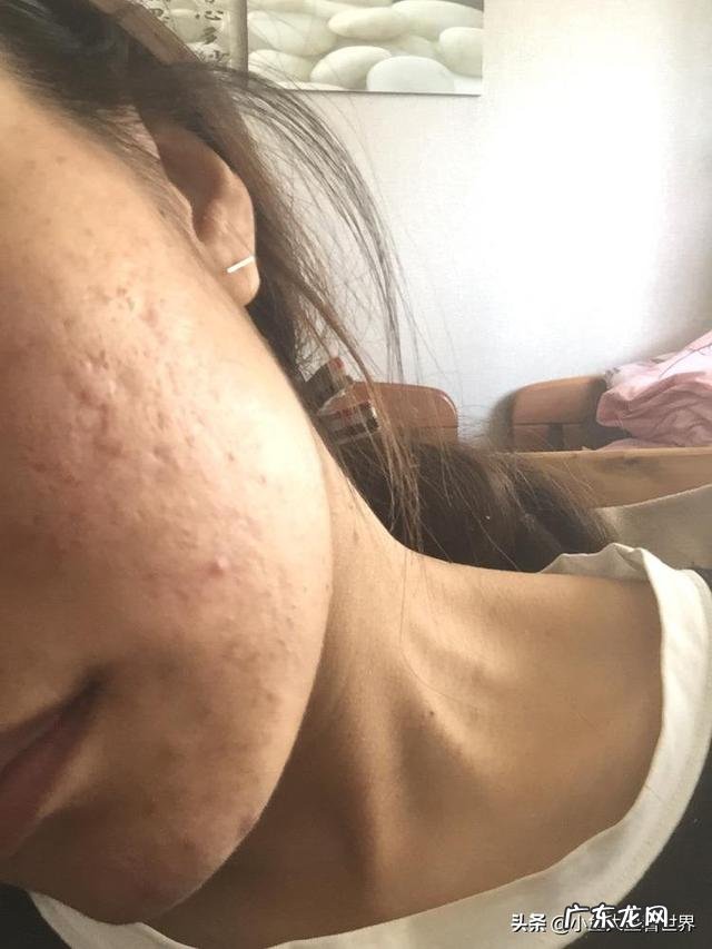 皮肤出油怎么选洁面产品,本人35岁,性别女