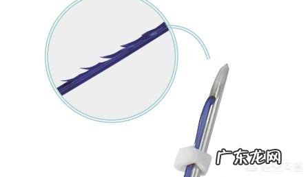 面部埋线提升失败的原因是什么？