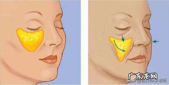 下巴尖,但是脸上的肉太多,额头又太宽,有什么方法可以纠正脸型