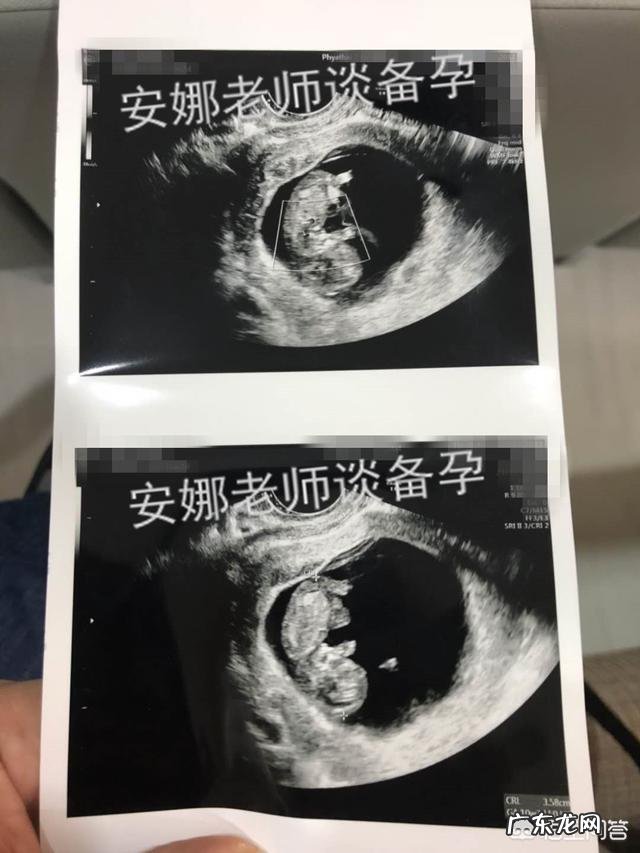 怀孕53天胎儿的样子是怎样呢？