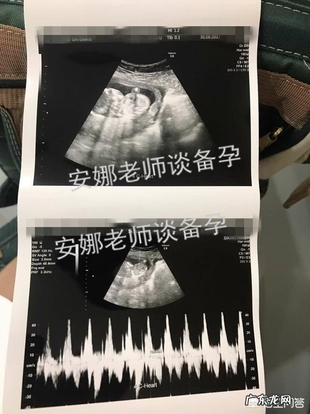 怀孕53天胎儿的样子是怎样呢？