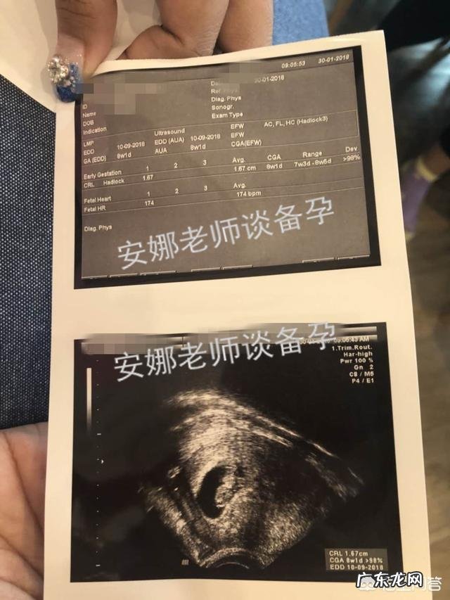 怀孕53天胎儿的样子是怎样呢？