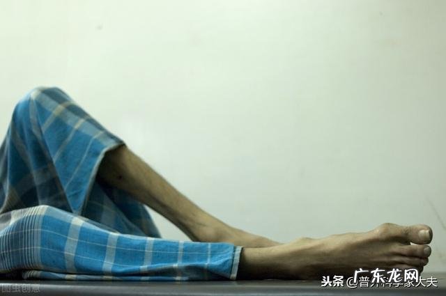 突然消瘦是癌症的征兆吗？