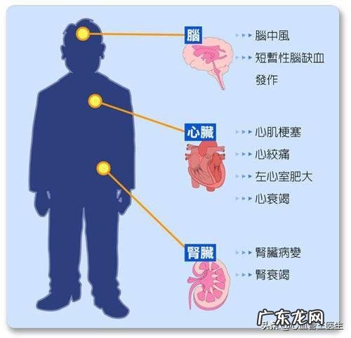 肥胖的高血压患者,血压和体重应该降低到多少?