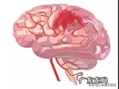 肥胖的高血压患者,血压和体重应该降低到多少?