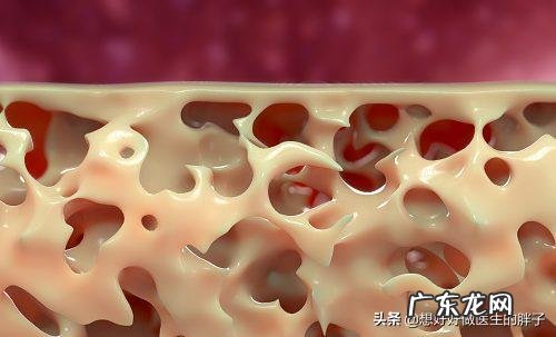 人到中年,骨质疏松,用什么方法补钙效果最好?