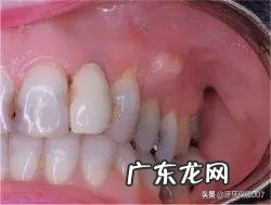 经常失眠,半夜醒来,难以入睡,吃什么东西可以改善睡眠质量