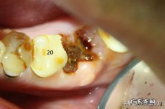 经常失眠，半夜醒来，难以入睡，吃什么东西可以改善睡眠质量