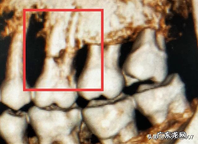 经常失眠,半夜醒来,难以入睡,吃什么东西可以改善睡眠质量