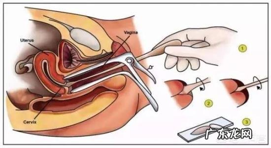 人流手术后,该如何护理和恢复