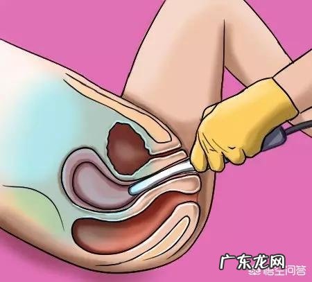 人流手术后,该如何护理和恢复