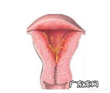 怀孕两个多月，胎儿为何会胎死腹中