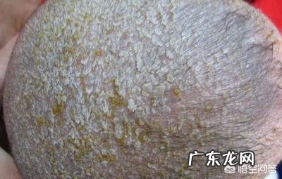 什么原因会导致新生儿的头上有污垢？