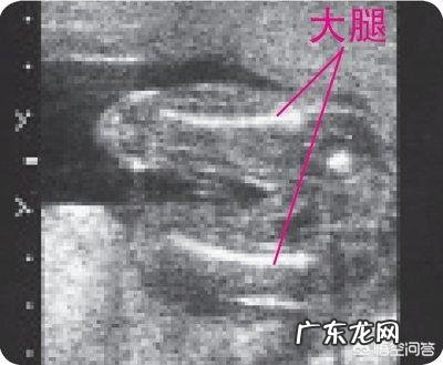 孕35周,胎儿股骨才58,正常吗?