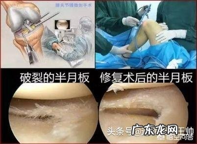 膝盖积液得了滑膜炎后适合什么运动?