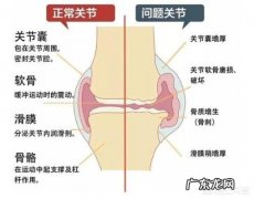 膝盖积液得了滑膜炎后适合什么运动？