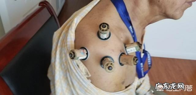 五岁宝宝滑膜炎不疼后怎么护理?