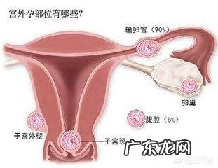 宫外孕过多久可以怀孕需要注意些什么