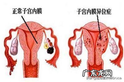 红糖姜水真的能减轻月经期的疼痛吗