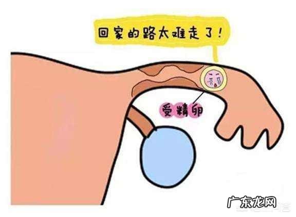 怀孕5周没有出血是不是就不是宫外孕