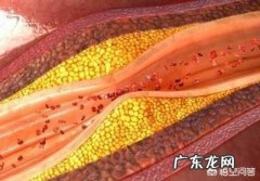 为什么冠心病患者不宜吃糖？