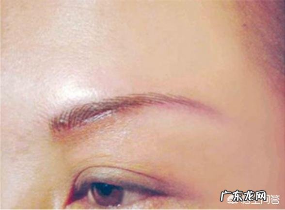 何为提眉术，能起到怎样的效果