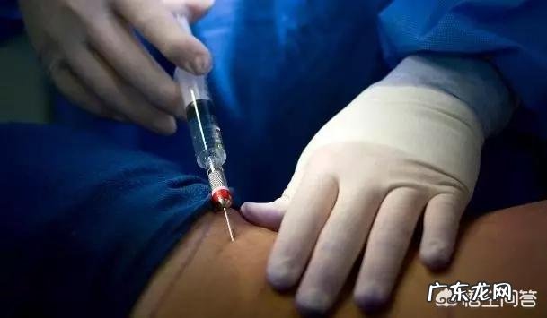 做手术时全麻是什么感觉?