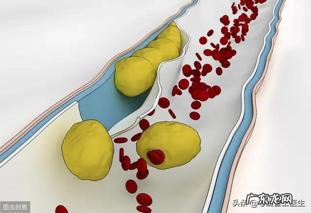 您好请问男40岁有高血压,适合吃鱼油预防心梗等疾病吗