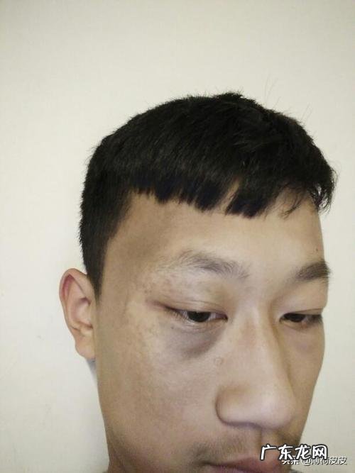 可不可以请大家推荐一下祛斑的方法