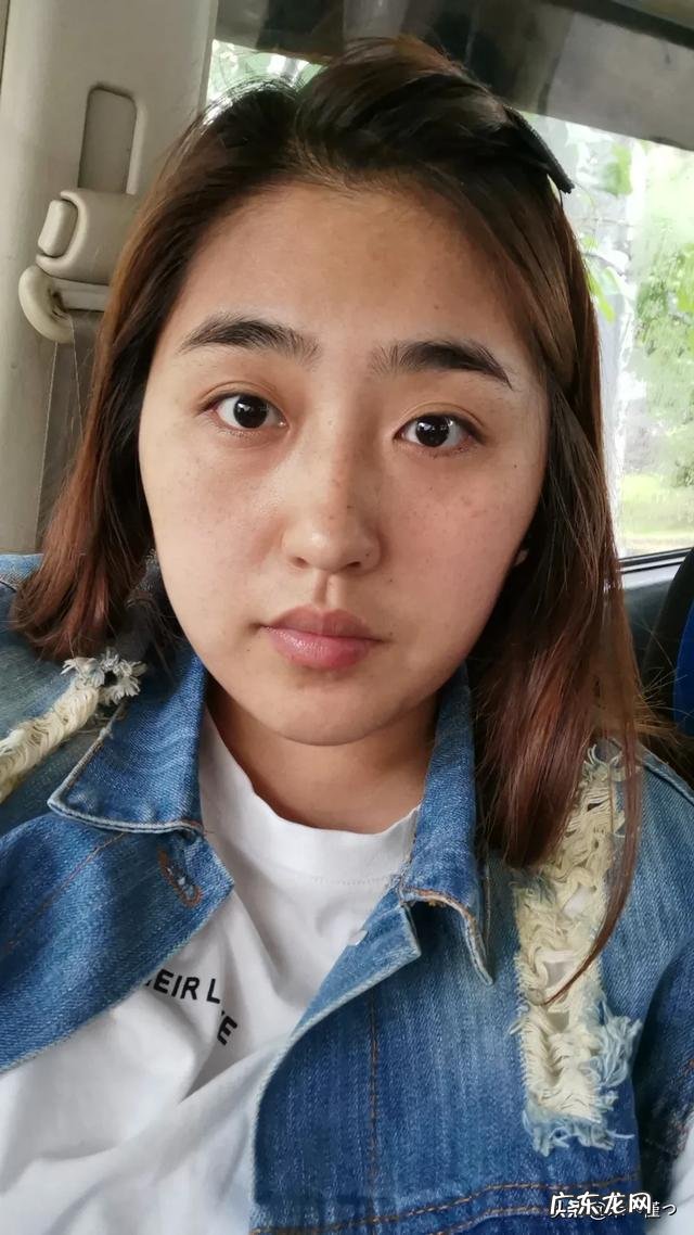 内分泌祛斑的最佳方法有哪些