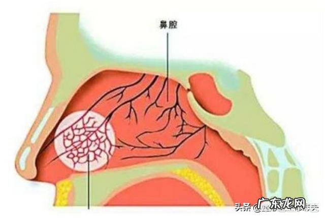 请问喜欢挖鼻孔,享受挖鼻孔的感觉是一种坏习惯吗?