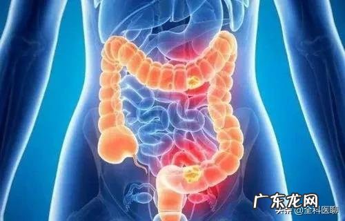 患有肠癌,上厕所有什么症状吗