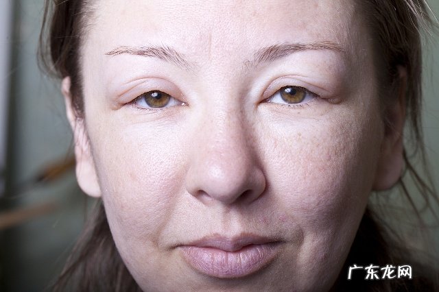 易胖水肿体质该如何去健康地减肥?