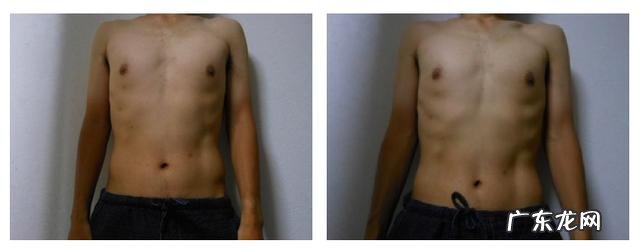 绝食时,会不会一天瘦一斤为什么呢