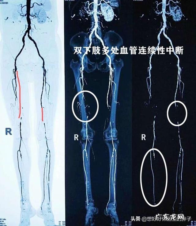 腿疼和做收腹运动有关系吗