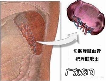 请问脾切除了,对身体有啥影响?