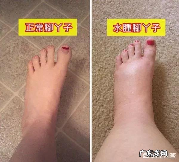 孕妇产检后体检结果出现浮肿，是怎么回事？