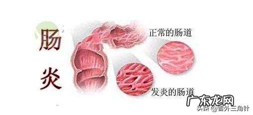 人渐消瘦是什么原因?要做哪些检查?