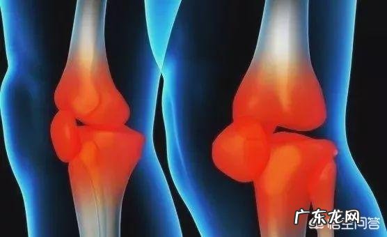 膝关节“弹响”,可能是这9个问题?